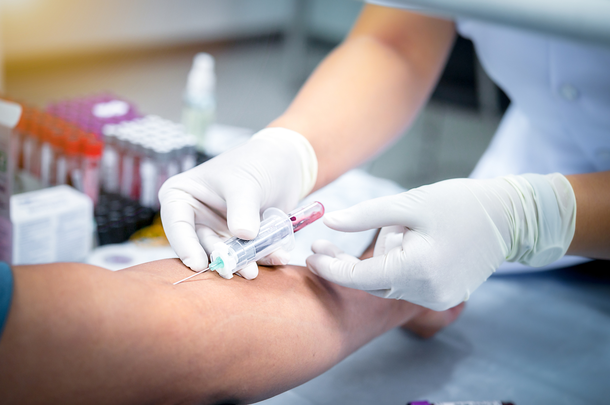 taking blood sample from a patient in the hospital. A healthcare professional wearing white gloves draws blood from a persons arm using a needle and syringe, with blood sample tubes visible in the background.