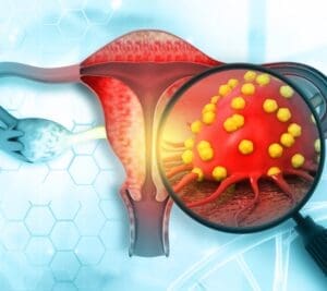 EndometrialCancerAD Images SQUARE