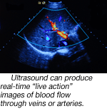 969 ultrasound img2